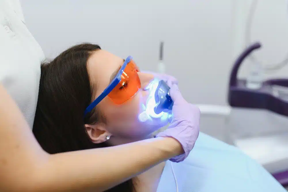 Woman Undergoing Teeth Whitening Procedure