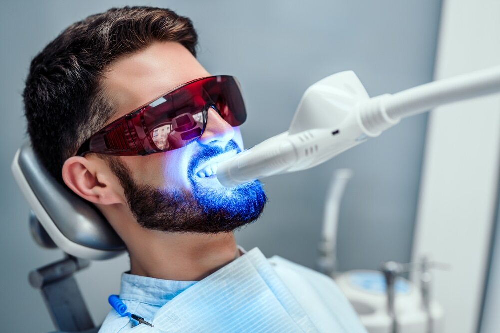How to Prepare for a Professional Teeth Whitening Session